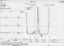 Sema Light Data Management Software (Schiller)