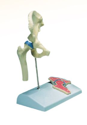 Model Hip Joint Miniature On Stand