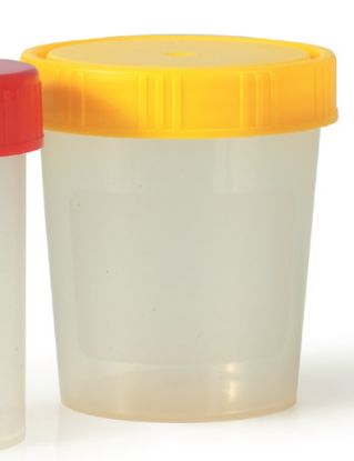 Urine Cup Screw On Yellow Cap x 10 Sterile