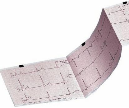 Ecg Paper For Ctcardiopad (Z-Fold 115mm)