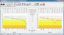 Audiometer Audiometric Audibase Pc Database