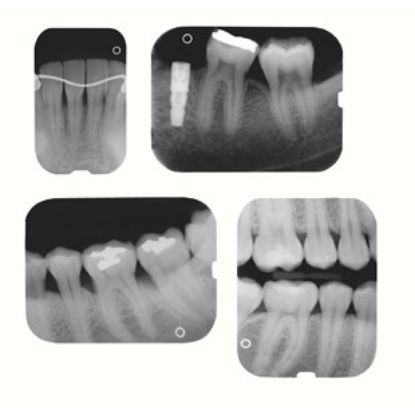 Imaging Plate (Gendex) Dentoptix Size 3 x 2