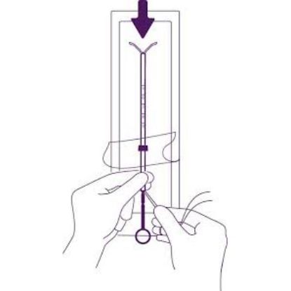 Levosert (Levonorgestrel 20Mcg / 24 Hours) Intra-Uterine Device x 1 (POM)