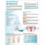 CHART ANATOMICAL MENOPAUSE UNDERSTANDING 50 X 65CM