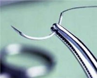 ethilon suture
