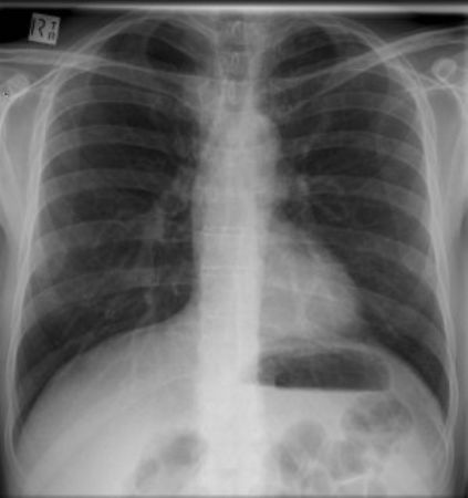 Picture for category X-Ray (Medical)