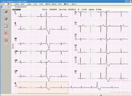 Picture for category ECG Data Viewer Software