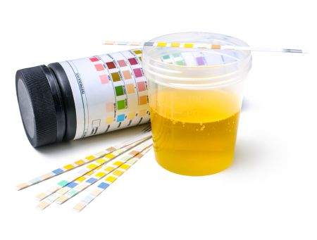 Picture for category Urine Analysis