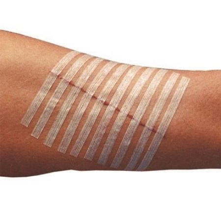 Picture for category Skin Closure Strips